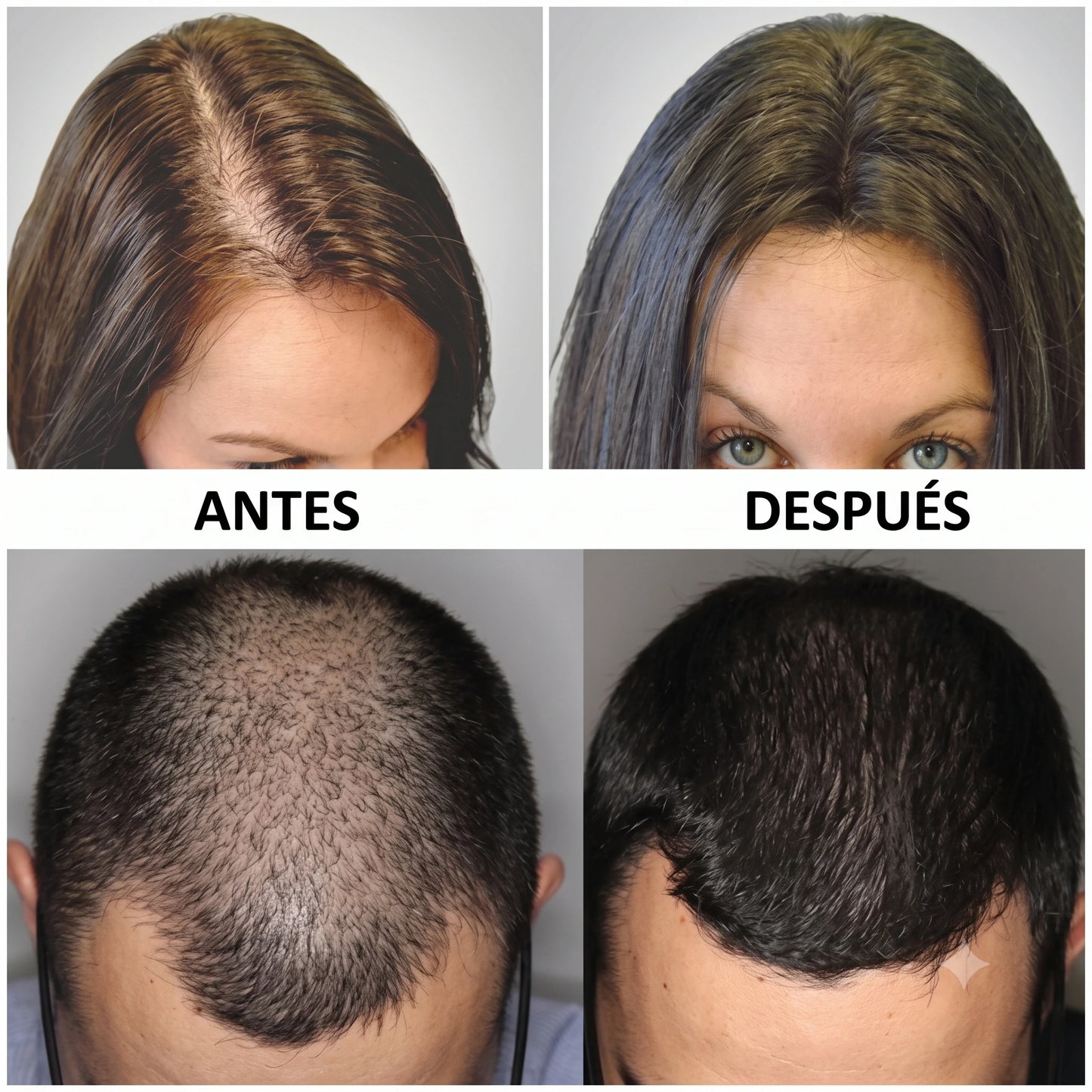 Bodywise Hair Growth